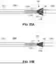 Fig. 22 - TRANSCATHETER VALVE RECAPTURE DEVICES AND METHODS