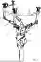 Fig. 02 - EXTERNAL FIXATION ASSEMBLY FOR POST-AMPUTATION PROSTHESIS