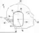 Fig. 01 - Earmuffs