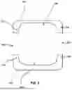 Fig. 11 - IMPLANTABLE ELECTRICAL LEADS AND ASSOCIATED DELIVERY SYSTEMS