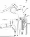 Fig. 16 - IMPLANTABLE ELECTRICAL LEADS AND ASSOCIATED DELIVERY SYSTEMS