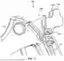 Fig. 17 - IMPLANTABLE ELECTRICAL LEADS AND ASSOCIATED DELIVERY SYSTEMS