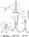 Fig. 45 - IMPLANTABLE ELECTRICAL LEADS AND ASSOCIATED DELIVERY SYSTEMS