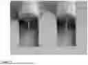 Fig. 05 - PHOTONIC WIRE BONDING METHODS AND PROCESSES FOR THE ADVANCED PACKAGING OF PHOTONIC DEVICES AND SYSTEMS