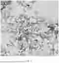 Fig. 05 - MODIFIED MONOCYTES/MACROPHAGES/DENDRITIC CELLS EXPRESSING CHIMERIC ANTIGEN RECEPTORS AND USES IN DISEASES AND DISORDERS ASSOCIATED WITH PROTEIN AGGREGATES