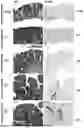 Fig. 01 - Method for detecting and subtyping inflammatory intestinal diseases