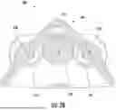 Fig. 37 - Lifter As Pet Hair Filter