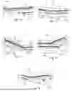 Fig. 08 - SET OF BUILDING PANELS COMPRISING A LOCKING DEVICE