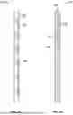 Fig. 03 - METHOD AND SYSTEM FOR CUTTING HYDRAULIC AND/OR ELECTRIC LINES IN THE ANNULAR SPACE OF A WELL