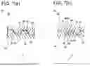 Fig. 08 - STEEL PIPE JOINT STRUCTURE AND METHOD FOR PROCESSING STEEL PIPE