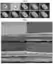 Fig. 08 - MACROSCOPIC LASER-INDUCED GRAPHENE