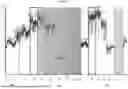 Fig. 06 - IDENTIFICATION AND QUANTITATION OF INSULIN-LIKE GROWTH FACTOR-I VARIANTS BY MASS SPECTROMETRY