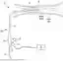 Fig. 01 - Low-profile shock wave catheters
