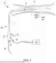 Fig. 02 - Low-profile shock wave catheters