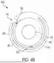 Fig. 06 - Low-profile shock wave catheters