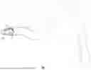 Fig. 02 - EXCISIONAL DEVICES AND METHODS