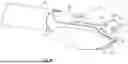 Fig. 27 - EXCISIONAL DEVICES AND METHODS