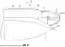 Fig. 28 - EXCISIONAL DEVICES AND METHODS