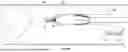 Fig. 47 - EXCISIONAL DEVICES AND METHODS
