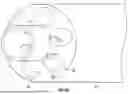 Fig. 64 - EXCISIONAL DEVICES AND METHODS