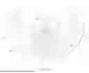 Fig. 29 - Externally Applied Intrapartum Support Device