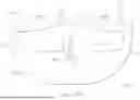 Fig. 48 - Externally Applied Intrapartum Support Device