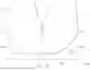 Fig. 50 - Externally Applied Intrapartum Support Device