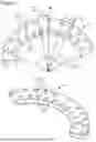 Fig. 02 - External Fixation for the Correction of Bone Deformity and Trauma