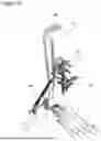 Fig. 22 - External Fixation for the Correction of Bone Deformity and Trauma