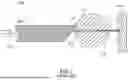 Fig. 02 - OPTIMIZATION OF BPH TREATMENT USING LEP (LASER ENUCLEATION OF PROSTATE)