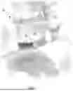 Fig. 02 - IMPLANT LOAD FEEDBACK APPARATUS