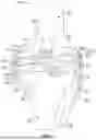 Fig. 05 - JOINT REPLACEMENT SYSTEM ENABLING JOINT MOVEMENT
