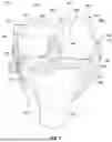 Fig. 06 - JOINT REPLACEMENT SYSTEM ENABLING JOINT MOVEMENT