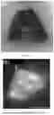 Fig. 06 - LIGHT-ACTIVATABLE, SUSTAINED-EXPOSURE ETHANOL INJECTION
