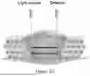 Fig. 16 - LIGHT-ACTIVATABLE, SUSTAINED-EXPOSURE ETHANOL INJECTION