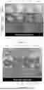 Fig. 30 - LIGHT-ACTIVATABLE, SUSTAINED-EXPOSURE ETHANOL INJECTION