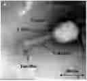 Fig. 01 - LYTIC PHAGE WITH HIGH SPECIFICITY TOWARDS PATHOGENIC ESCHERICHIA COLI