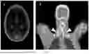 Fig. 07 - METHODS AND MATERIALS FOR IMAGING ADIPOSE TISSUE