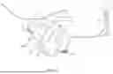 Fig. 06 - ASSESSING FALLOPIAN TUBAL PATENCY