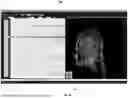 Fig. 06 - Systems and Methods of Integrating Electrophysiological Data with a Visual Representation of Associated Electrodes and Contacts in a Patient-Specific Three-Dimensional Brain Model
