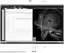 Fig. 09 - Systems and Methods of Integrating Electrophysiological Data with a Visual Representation of Associated Electrodes and Contacts in a Patient-Specific Three-Dimensional Brain Model