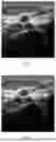 Fig. 04 - Method for Ultrasonic Panoramic Imaging