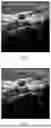 Fig. 06 - Method for Ultrasonic Panoramic Imaging