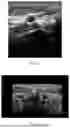Fig. 07 - Method for Ultrasonic Panoramic Imaging
