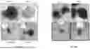 Fig. 07 - SYSTEMS AND METHODS OF ENHANCING TUMOR-REACTIVE IMMUNE POPULATIONS WITH ORGANOIDS