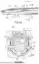 Fig. 06 - TREATMENT DEVICE WITH DAMPING FEATURE