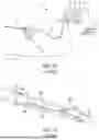 Fig. 09 - TREATMENT DEVICE WITH DAMPING FEATURE