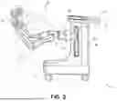 Fig. 03 - CANNULA ASSEMBLY