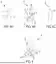 Fig. 05 - Device for Fixating Orthopedic Injury