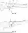 Fig. 07 - Device for Fixating Orthopedic Injury